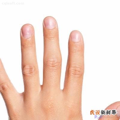 得了灰指甲,怎么办?