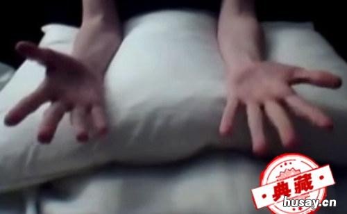 手腕骨折后康复训练 手腕骨折后康复训练最佳方法视频