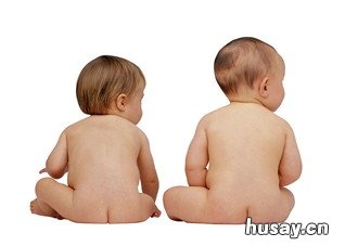 儿童血铅含量的标准 儿童铅中毒血铅标准