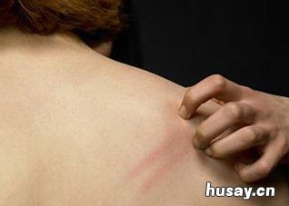 谨防三大皮肤异常症状 皮肤的各种问题症状