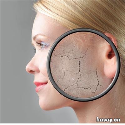 脸上皮肤干燥起皮怎么办 脸上皮肤干燥起皮怎么回事