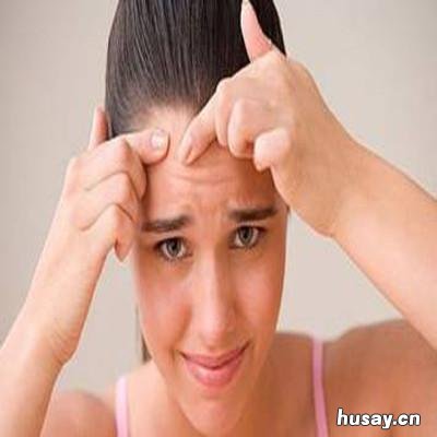 额头长痘痘怎么消除好 额头长痘痘怎么消除好得快