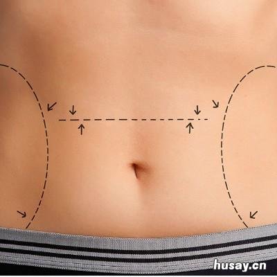 怎样减肥又快又健康 中年女人怎样减肥又快又健康