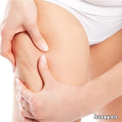 苹果醋红糖泡香蕉能减肥吗 香蕉果醋红糖减肥法有效果吗