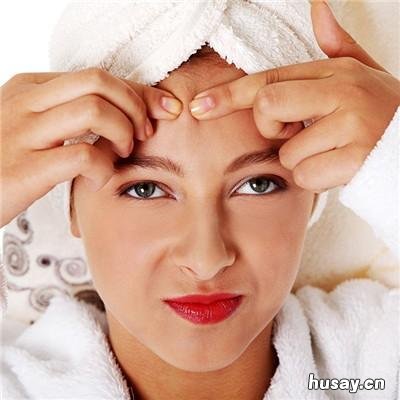 青春期痤疮怎么治 青春期痤疮治疗时没有新出的疙瘩了再吃多长时间的药