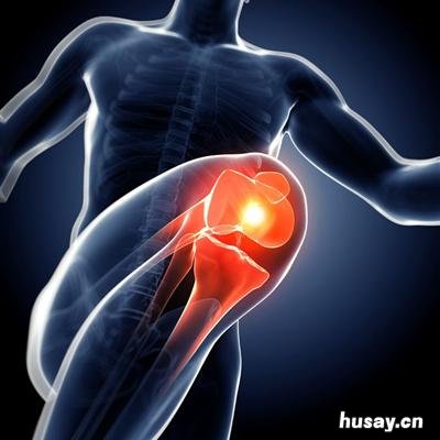 压缩性腰椎骨折是什么 压缩性腰椎骨折是什么引起的