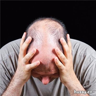 头发掉了一块是什么原因引起的 头发掉了一块是什么原因男性