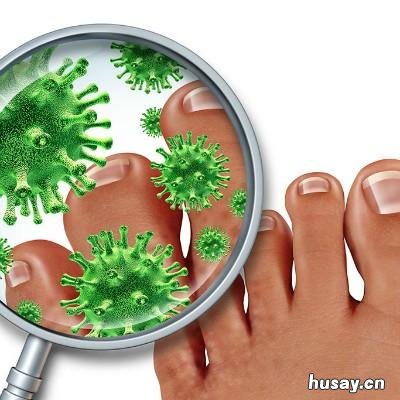 疥疮是什么 疥疮是什么皮肤病