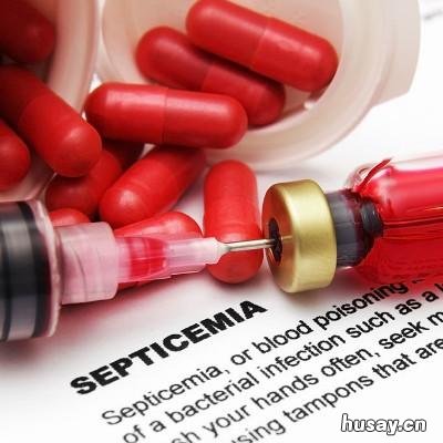 被艾滋病人咬伤没出血会感染吗 被艾滋病人咬破皮没有出血