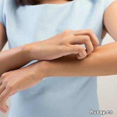 白癜风早期能治愈吗?会传染吗?