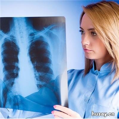 乳腺癌早期能活多久? 36岁乳腺癌早期能活多久