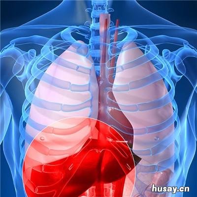 乙肝大三阳是什么 乙肝大三阳是什么病