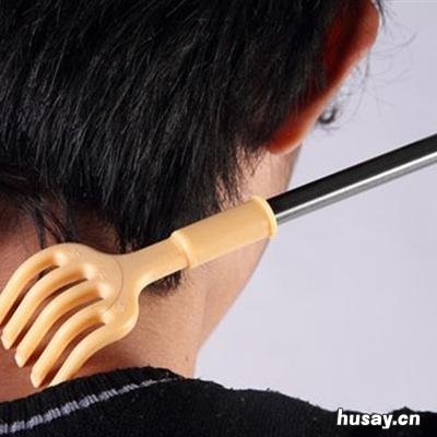 体癣怎么治疗 儿童体癣怎么治疗