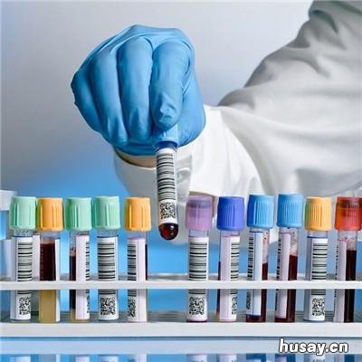 再生障碍性贫血是白血病吗 再生障碍性贫血是白血病吗就搜索济南血液病