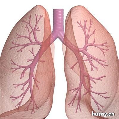 肺结核遗传吗 肺结核遗传吗算基因病吗