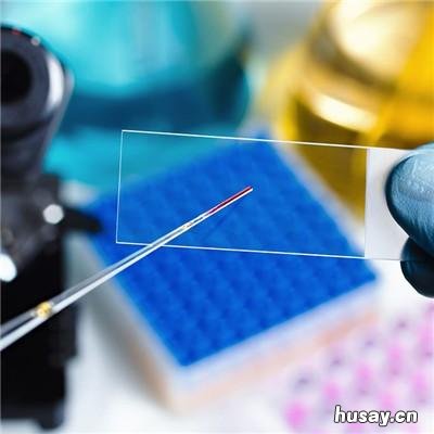 什么是乙肝病毒携带者 啥是乙肝病毒携带者