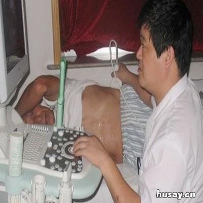 心脏瓣膜手术后寿命是多久 心脏瓣膜手术存活期多少年