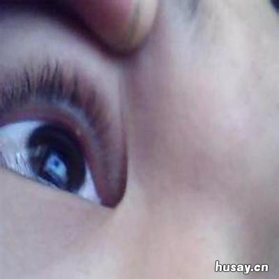 眼睑上长小颗粒怎么办 眼睑外面长小颗粒怎么办