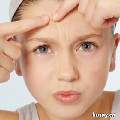 脸上长痘痘是什么原因 小孩子脸上长痘痘是什么原因