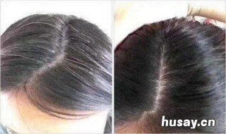 白头发是什么原因 三十多岁就有白头发是什么原因