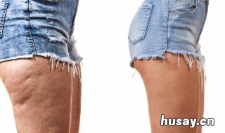 下半身肥胖的原因是什么 下半身肥胖的原因是什么 中医
