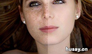 脸上的斑怎么能去掉 生完宝宝脸上的斑怎么能去掉