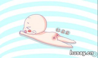 BB屁股发红怎么办 宝宝总红屁股怎么办