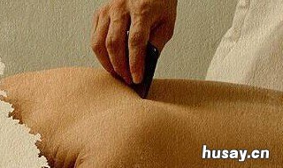 刮痧是什么意思 刮痧是什么意思网络用语