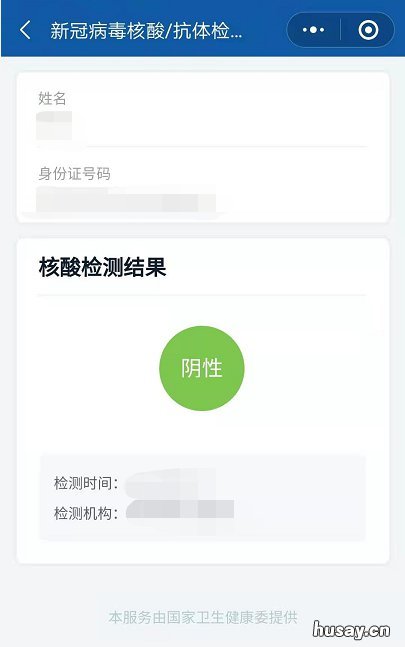 2021无锡48小时的核酸检测报告从什么时候开始计算? 2021无锡48小时的核酸检测报告在哪里查