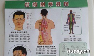 发烧可以刮痧吗 新冠发烧可以刮痧吗