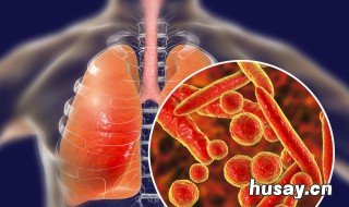 肺炎吃什么好 支气管肺炎吃什么好