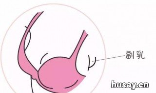 人头乳瘤病毒最严重的一项是哪一项 人头乳瘤病毒最严重的一项是什么病