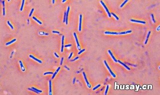 枯草芽孢杆菌的芽孢能耐多少度的温度? 枯草芽孢杆菌产芽孢吗