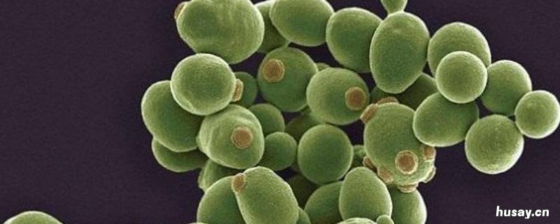 酵母属于什么菌 酵母是一种什么菌