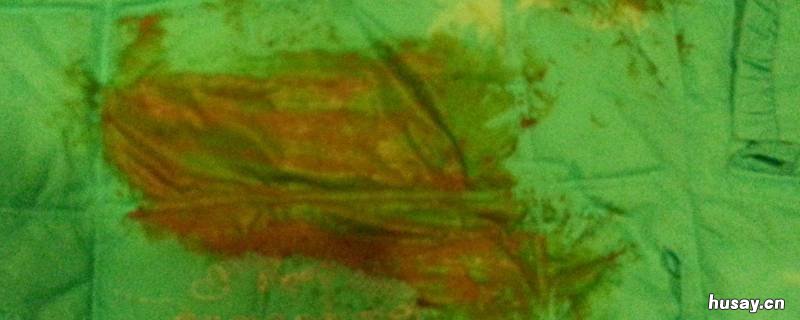 羽绒服沾上泥巴怎么处理 羽绒服上的橡皮泥怎么去掉